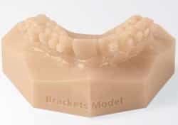 3d printing in orthodontics